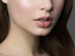 Woman with smooth, youthful skin after Exion® Fractional RF treatment