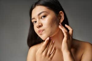 Young woman looks at her acne breakouts in the mirror as she thinks about scheduling red and blue light therapy.
